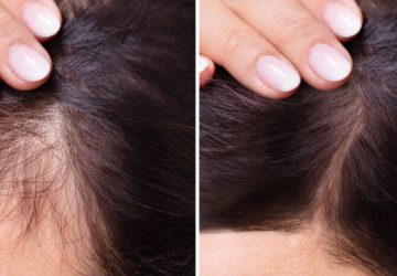 vysledky-osetreni-1-1024x461